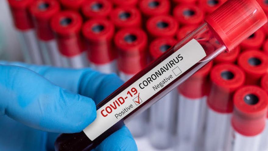 Baleares registra ya 92 casos de coronavirus