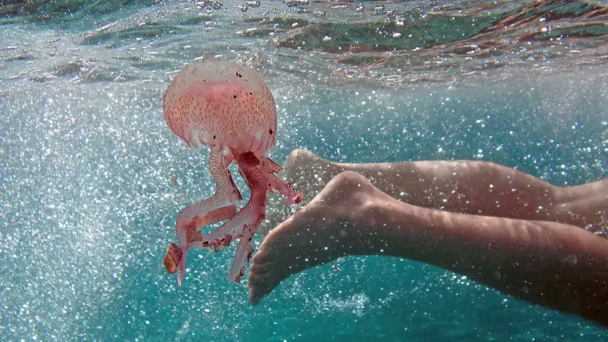 ¿Cómo actuar en caso de sufrir una picadura de medusa?