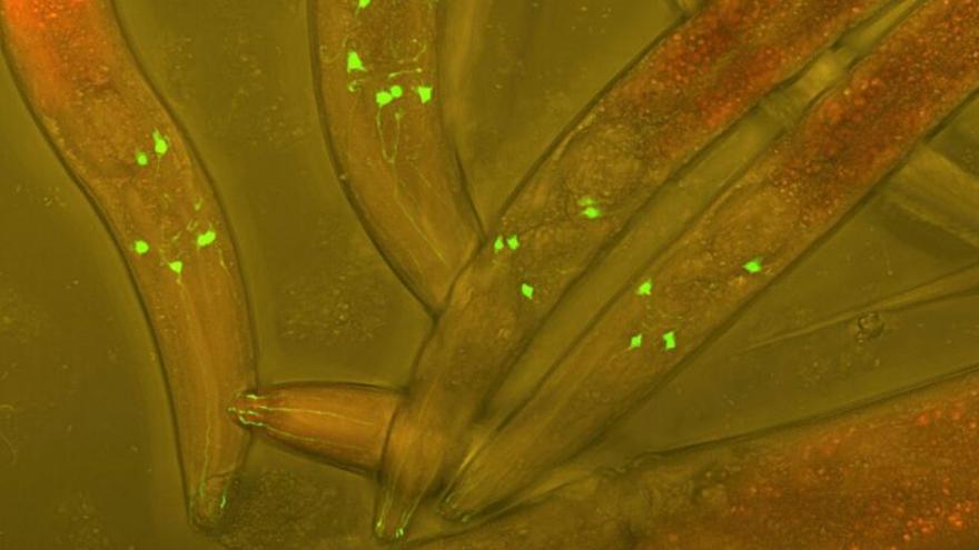 Un sistema de sinapsis artificial reconecta circuitos neuronales a distancia