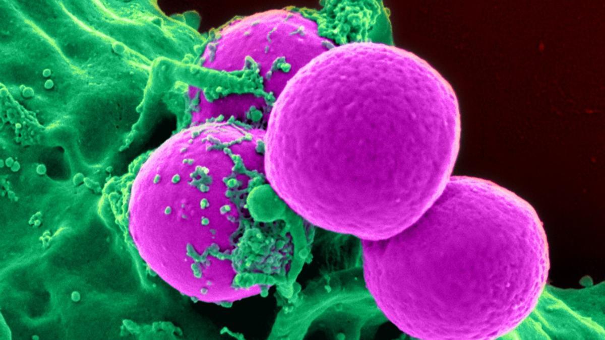 Las bacterias resistentes serán el siguiente gran problema de alud pública