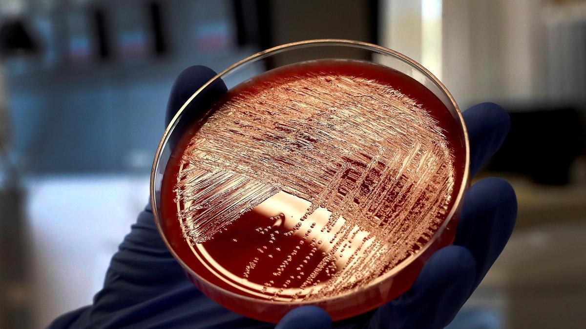 Análisis de un alimento en el Centro Nacional de Microbiología.