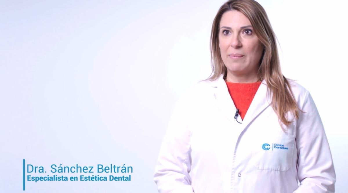 ¿Qué son las carillas dentales? ¿para qué sirven? ¿cuándo se recomiendan?