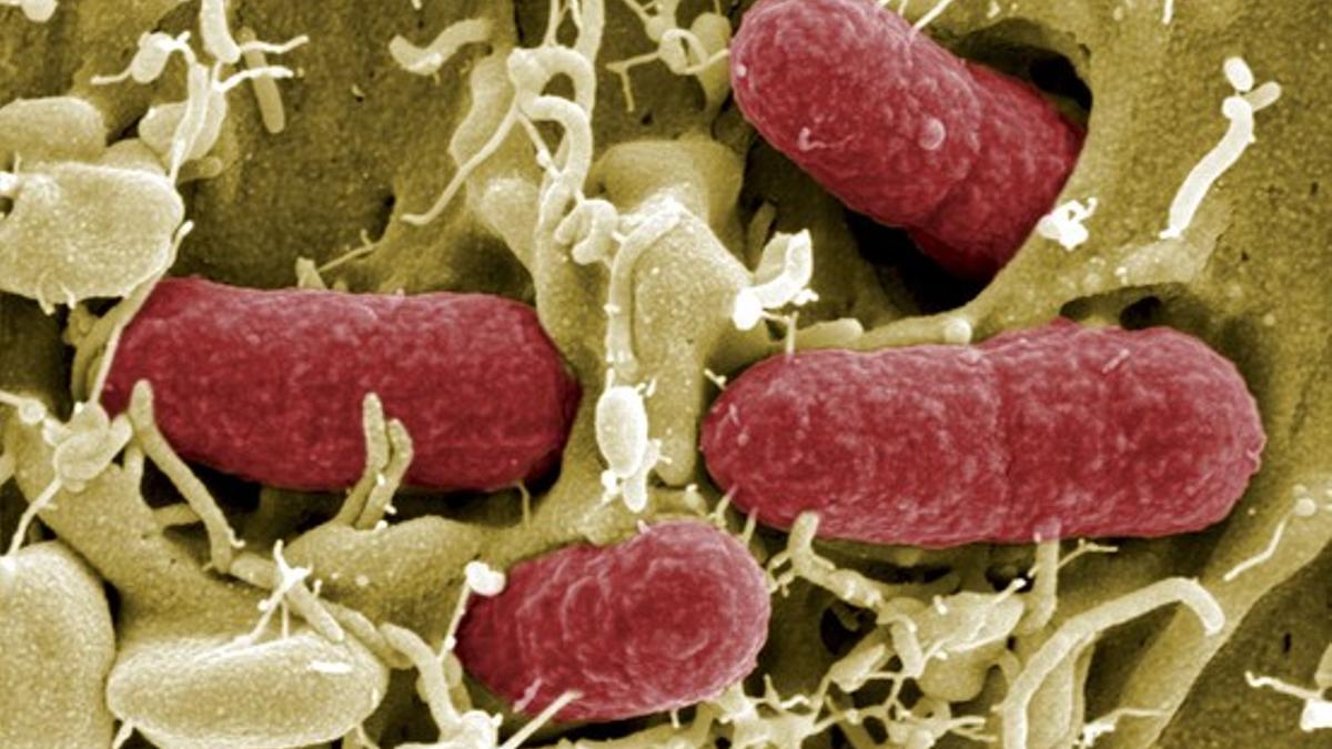 Bacterias escherichia coli vistas con un microscopio electrónico.