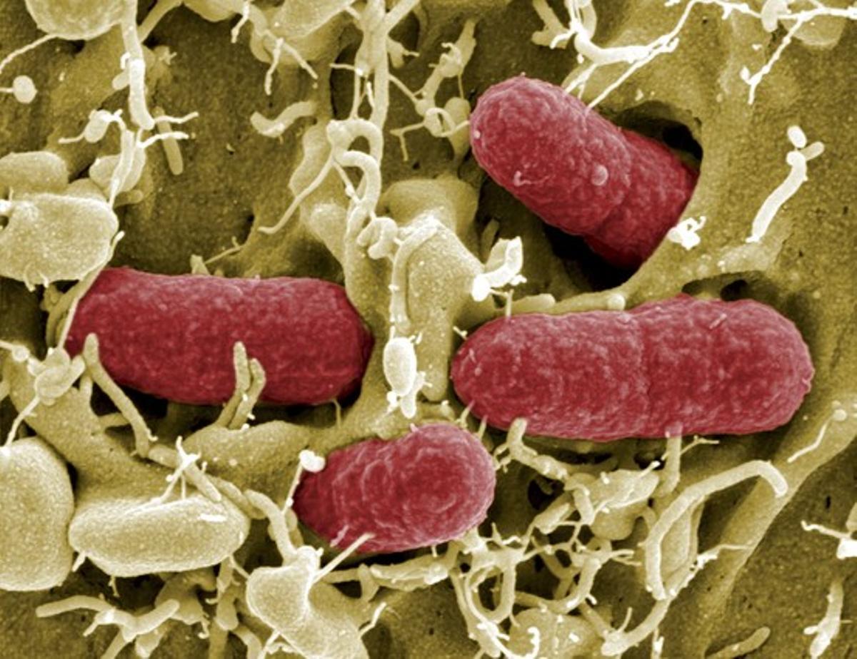 Bacteris escherichia coli vistos amb un microscopi electrònic.