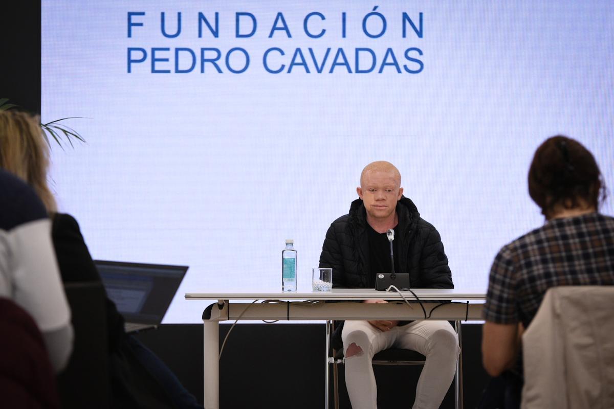 Cavadas reconstruye la cara a un paciente albino