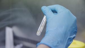Archivo - Una técnico de laboratorio sostiene una de las pruebas de análisis para la viruela.