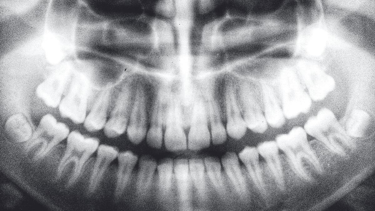 Una ortopantomografía o radiografía panorámica.