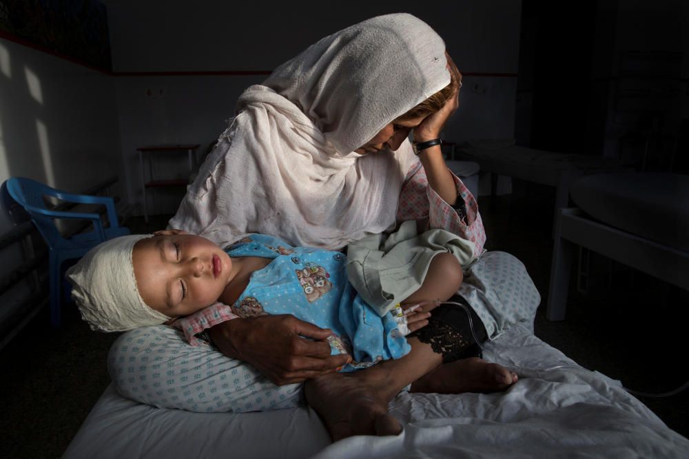 Najiba sostiene a su sobrina de dos años de edad Shabir, herida en una explosión en Kabul, Afganistán. Primer premio de la sección individual de Vida diaria. Fotografía de Paula Bronstein.