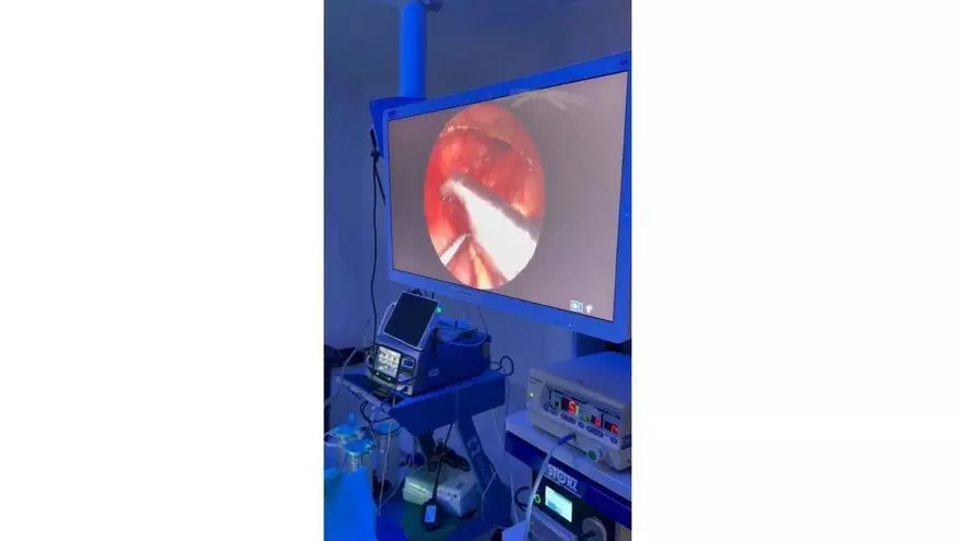 El Hospital Quirónsalud Málaga realiza una compleja cirugía de esófago a un bebé de 24 horas de vida