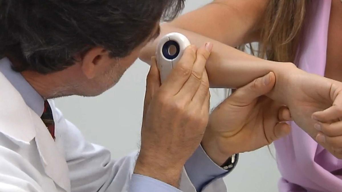 El cáncer de piel ha aumentado un 40 por ciento en cuatro años