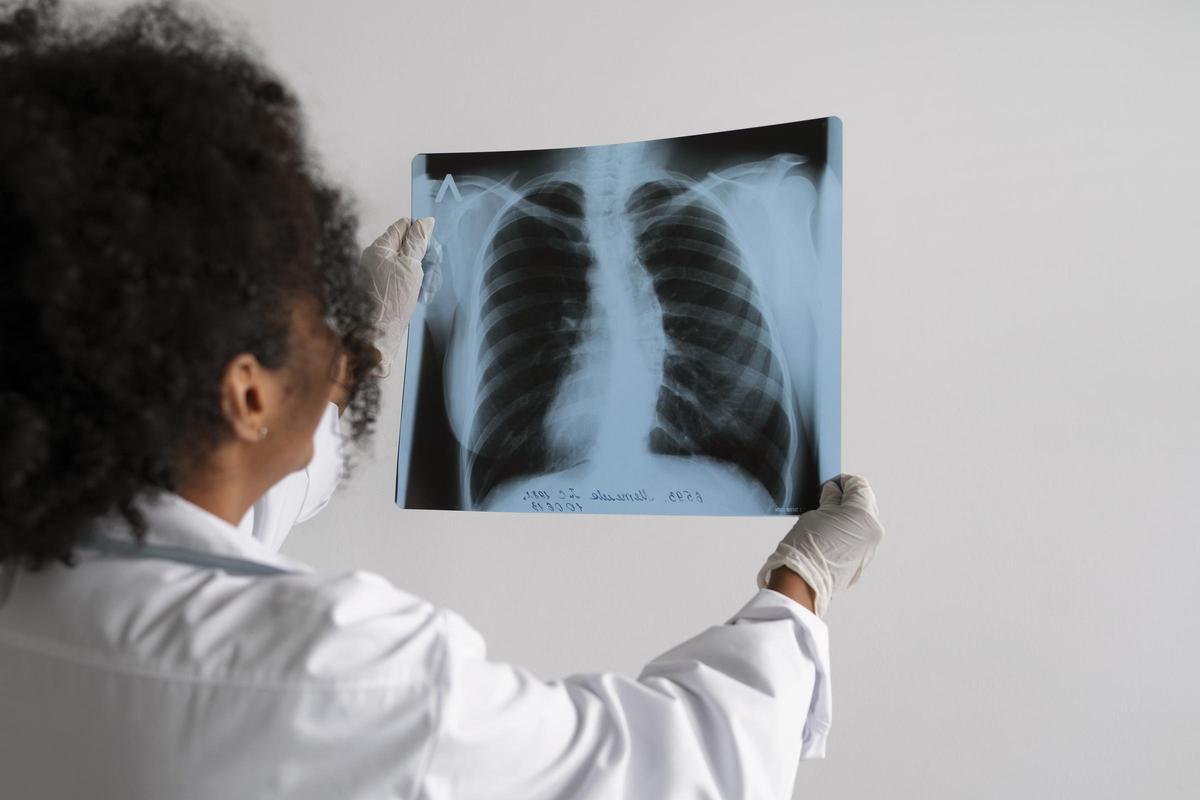 Radiografia de pulmons