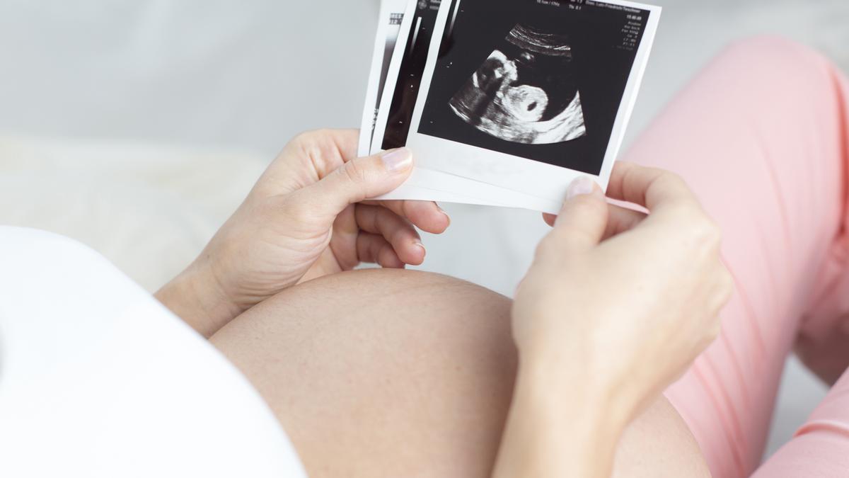 Una mujer embaraza comprueba una de las imágenes de su ecografía