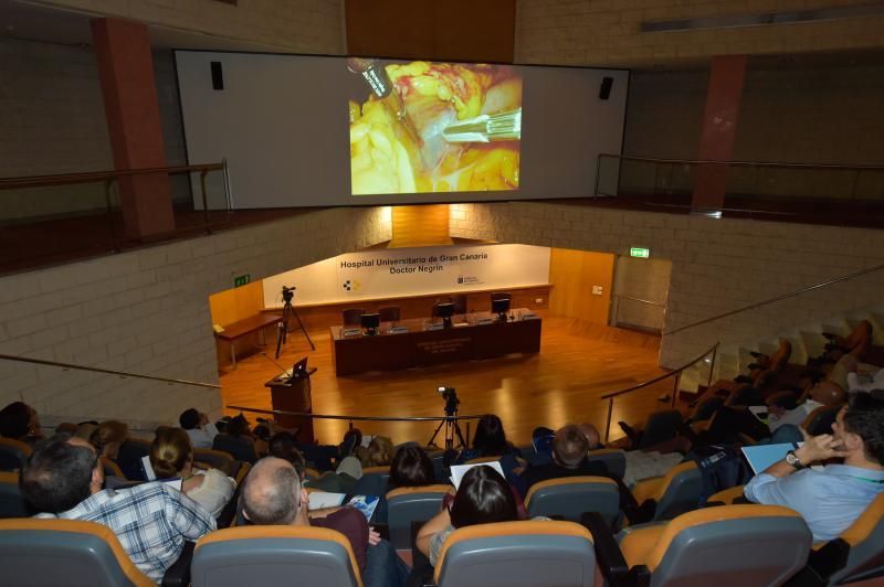 25-10-2018 LAS PALMAS DE GRAN CANARIA. Cirugía pancreática laparoscópica en el hospital Doctor Negrín. Fotógrafo: ANDRES CRUZ  | 25/10/2018 | Fotógrafo: Andrés Cruz