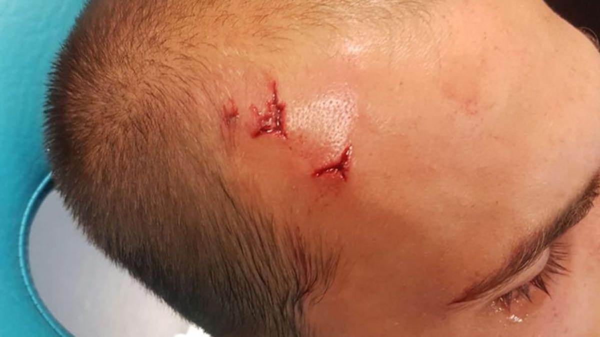 Bas Dost fue agredido en el vestuario del Sporting