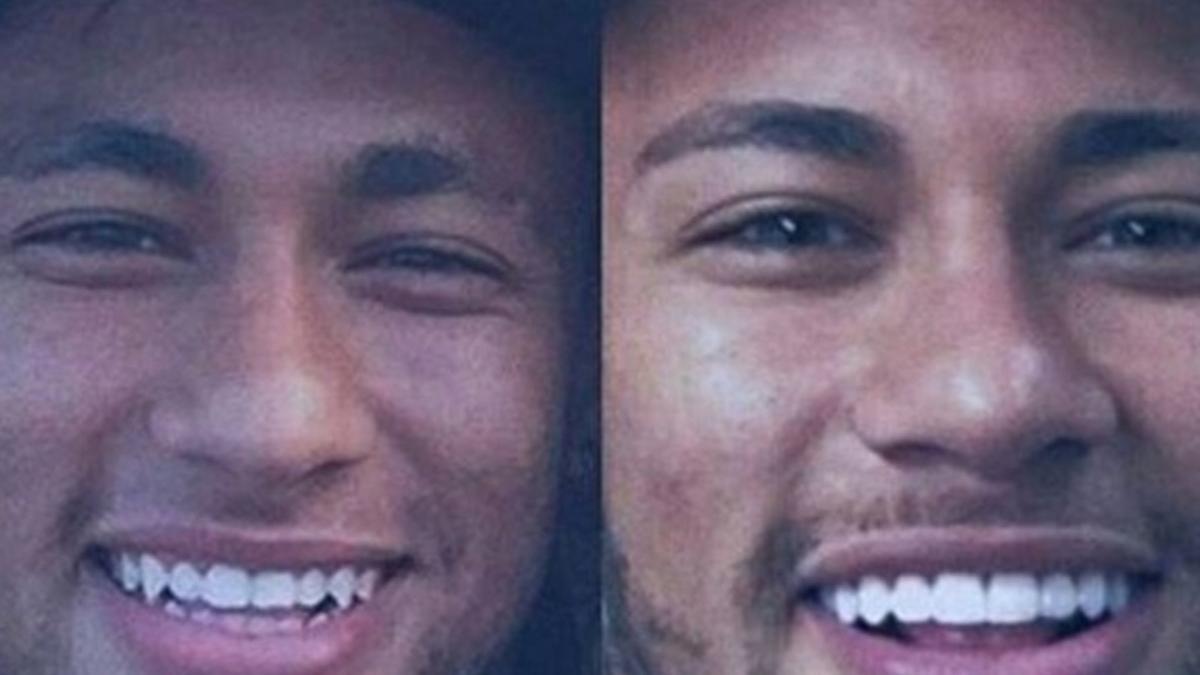 Neymar luce una nueva dentadura