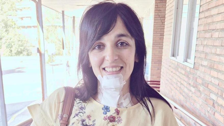 Sílvia Orriols pateix cremades a la cara i braços per un incendi a la cuina de casa seva