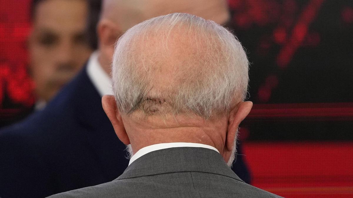 Lula, de espaldas, con la herida que se hizo en la cabeza en pasado mes de octubre.