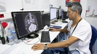 Los ictus frenan la vida de siete murcianos cada día: los especialistas alertan de pacientes cada vez más jóvenes
