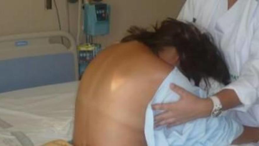 Una mujer denuncia quemaduras de tercer grado tras recibir la epidural