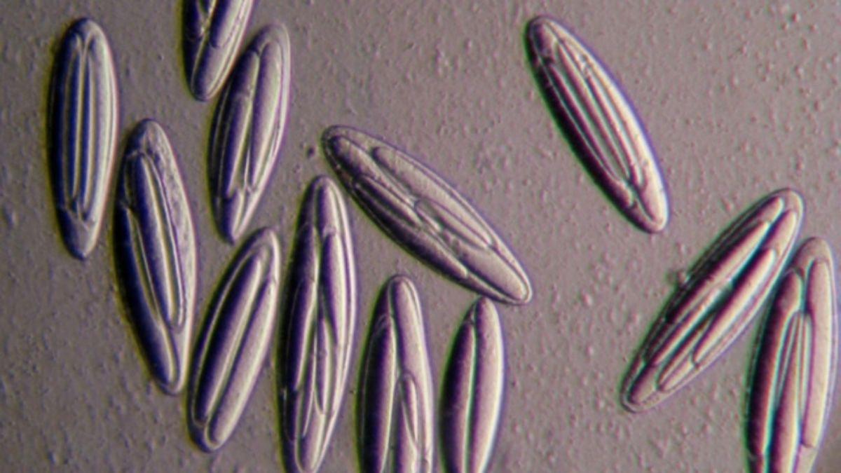 Micrografía de un grupo de bacterias Epulopiscium viviparus.