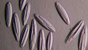 Micrografía de un grupo de bacterias Epulopiscium viviparus.