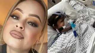 Una mujer sufre cuatro amputaciones tras tomar un pescado infectado