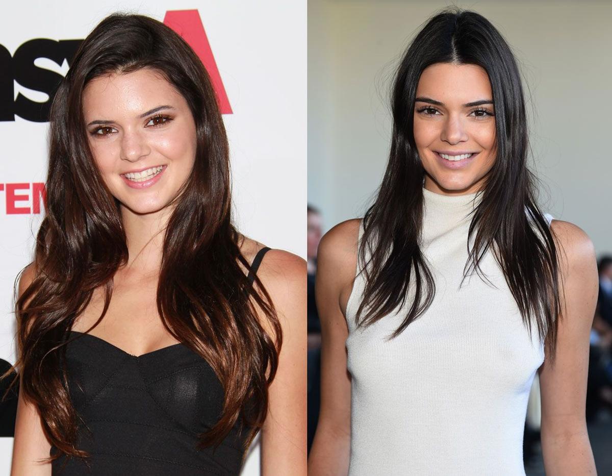 El antes y el después: Kendall Jenner