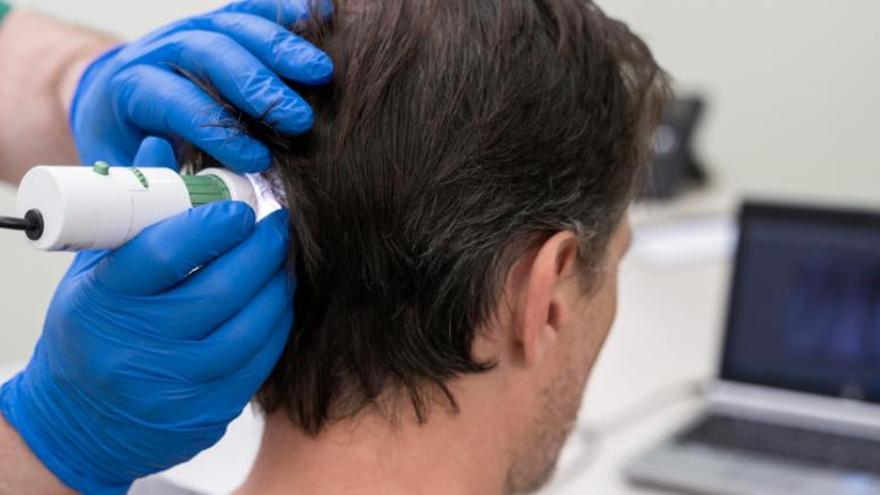 &quot;El test genético nos permite ofrecer un tratamiento más personalizado y eficaz para la pérdida de cabello&quot;