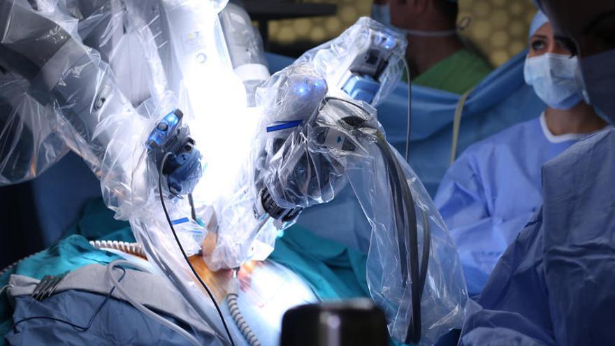 Cirugía asistida por un robot.