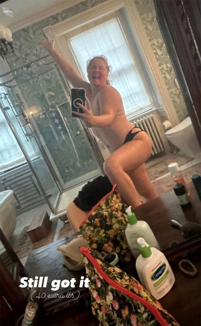 Amy Schumer y su selfi en topless en Instagram