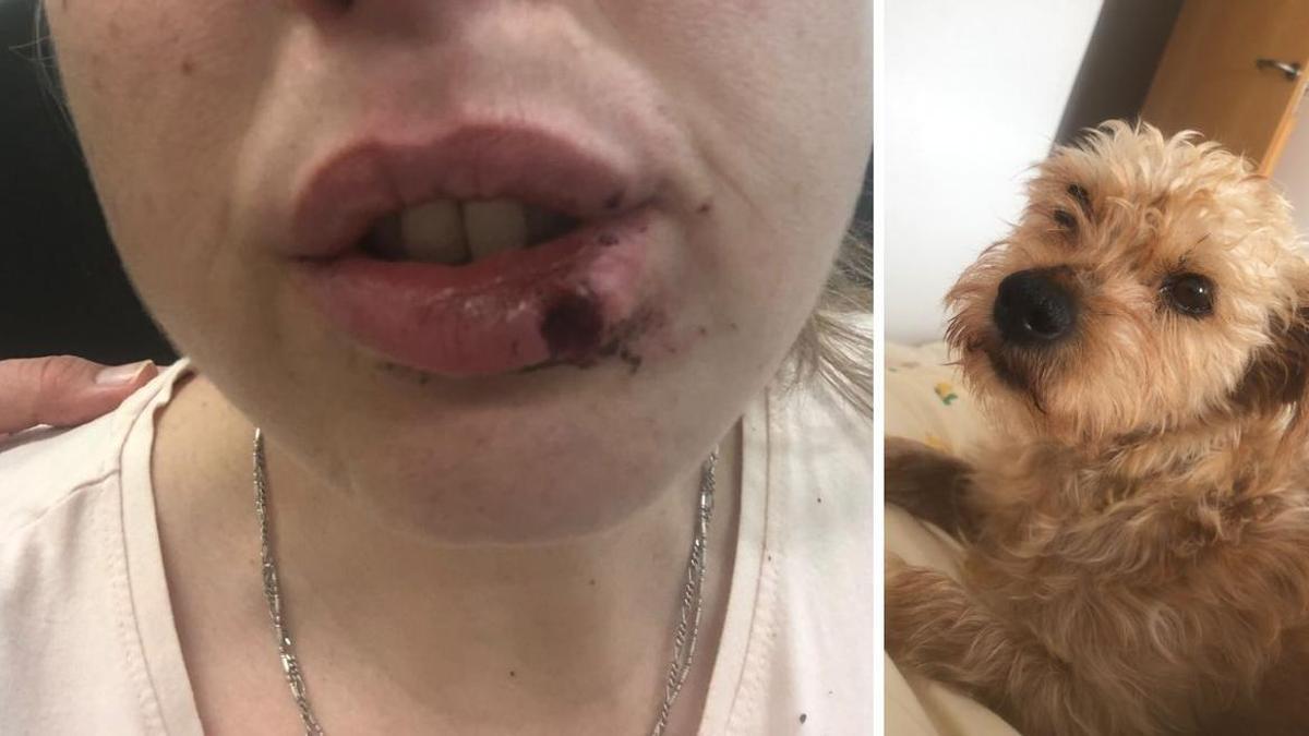 Un perro muerde a una vecina de Navia cuando protegía a su perra del ataque: Eira huyó pero apareció tras tres días perdida