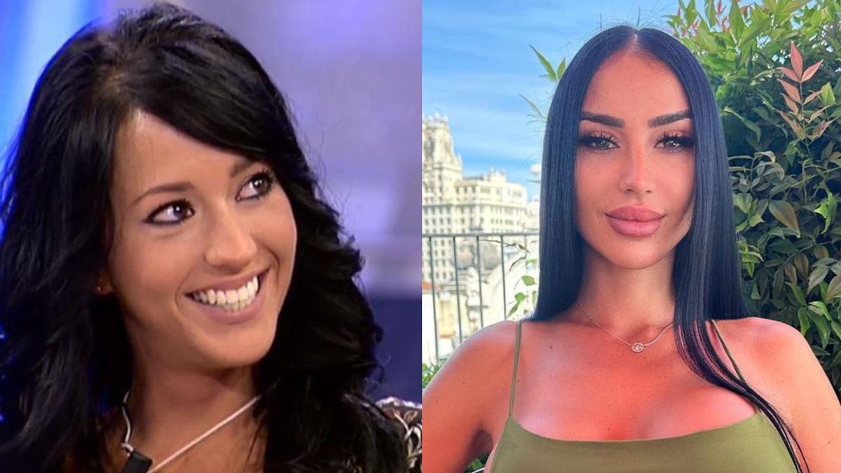 Aurah Ruiz antes y después | Todas las operaciones y retoques estéticos de Aurah  Ruiz, concursante de Supervivientes