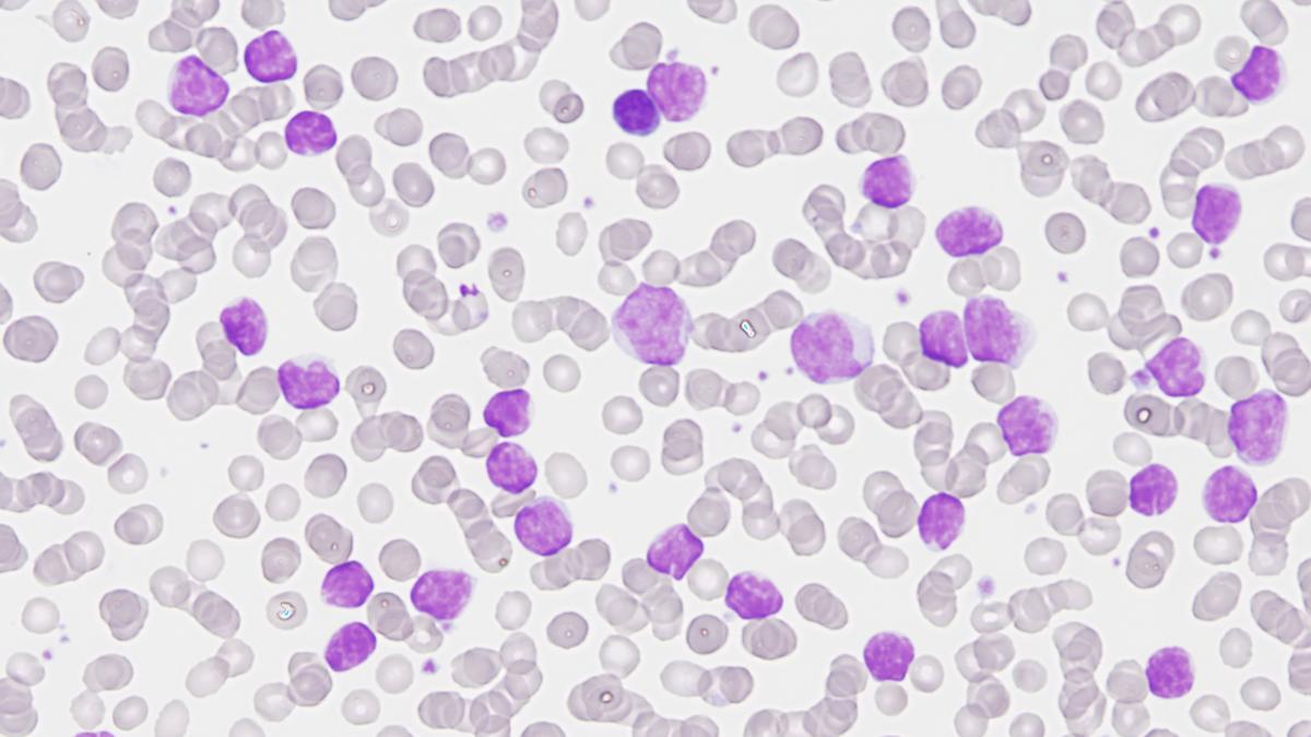 Imatge d'una citologia sanguínia