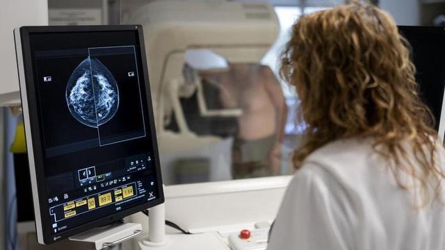 Una dona es fa una mamografia