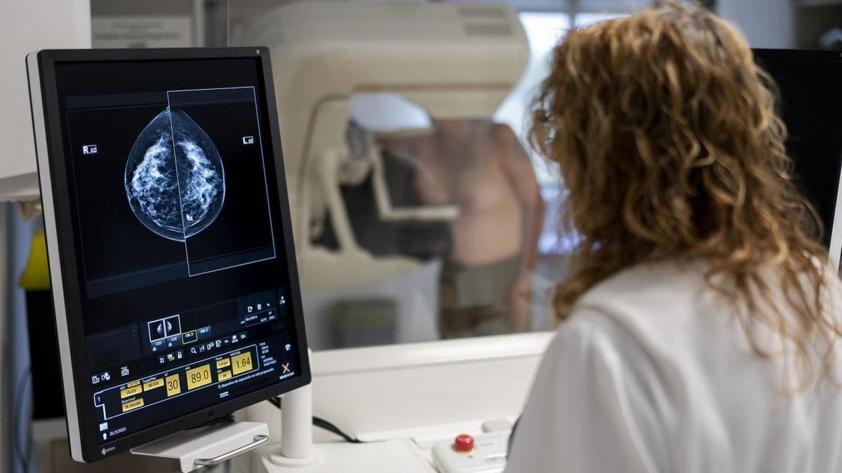 Una mujer se realiza una mamografía