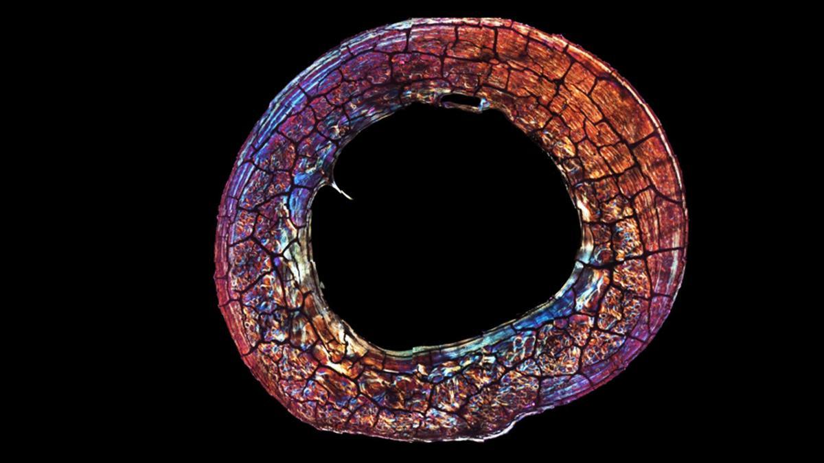 Imagen microscópica de la sección del eje medio de un fémur de primate.