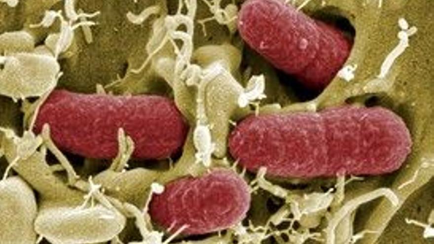 Aumentan hasta 30 las víctimas mortales por el brote infeccioso de &#039;&#039;Escherichia coli&#039;&#039; en Europa
