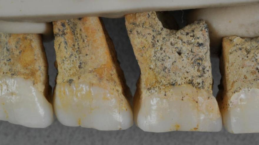 Dentadura del Homo luzonensis