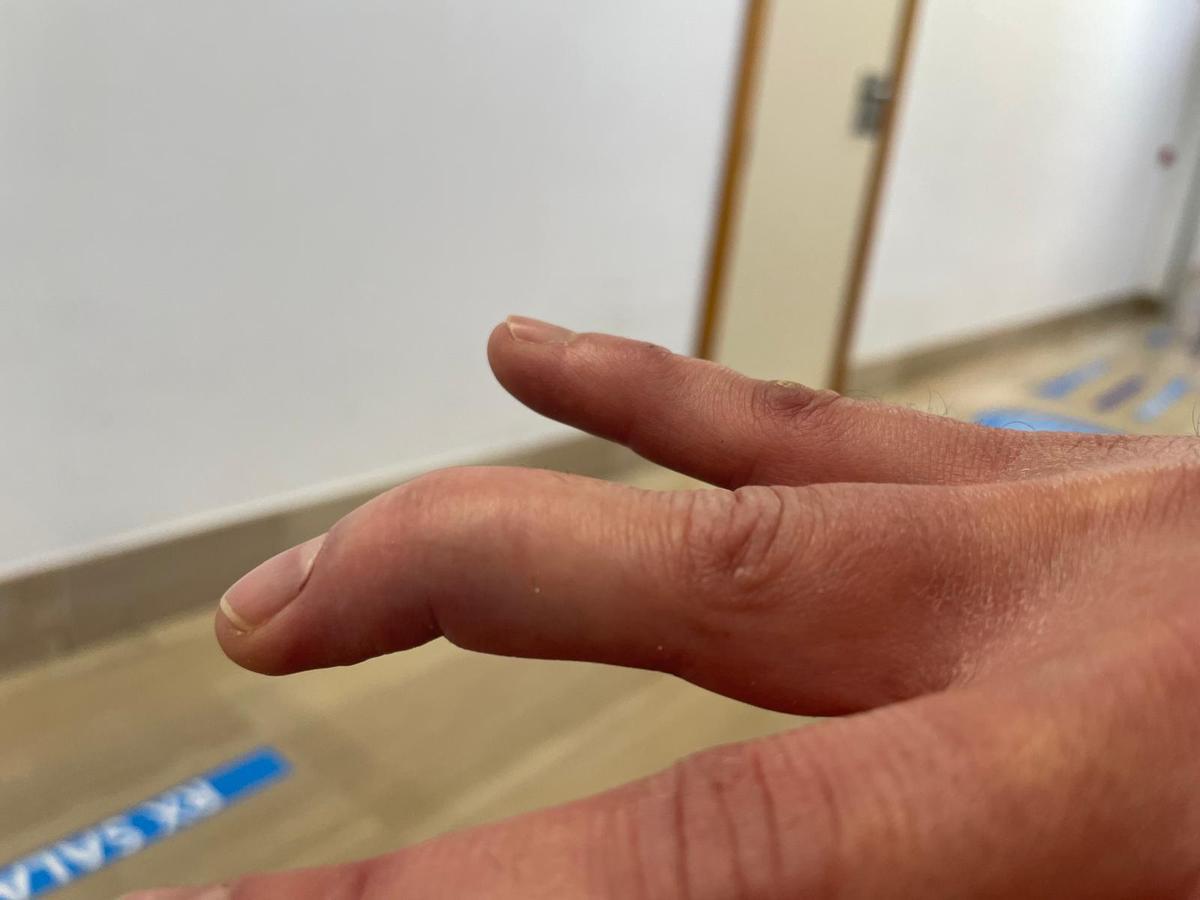 El funcionario ha resultado herido en una mano durante el forcejeo.