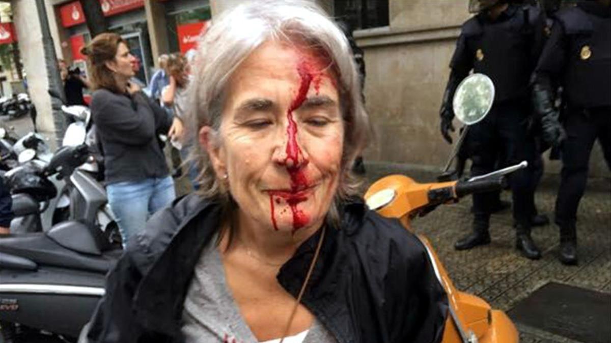 Una mujer ha resultado herida durante la carga policial en la escuela Infant Jesús de Barcelona.