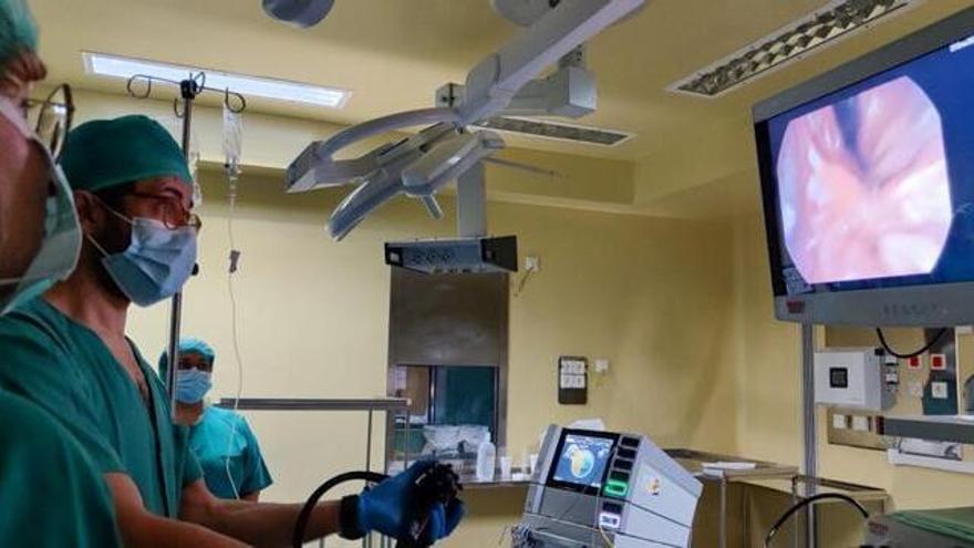 VÍDEO: El Hospital Valle del Nalón realiza con éxito la primera intervención en Asturias por vía oral y sin incisiones para solucionar complicaciones tras un bypass gástrico