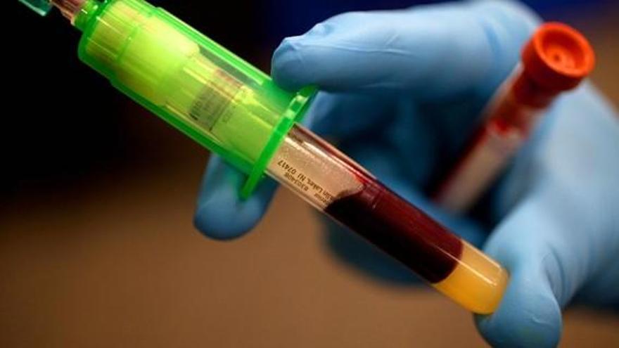 Un análisis de sangre podría detectar tumores 4 años antes del diagnóstico convencional