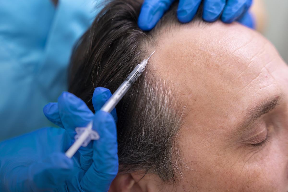 Cada vez es más común ver personas que se someten a tratamientos para fortalecer el cabello.