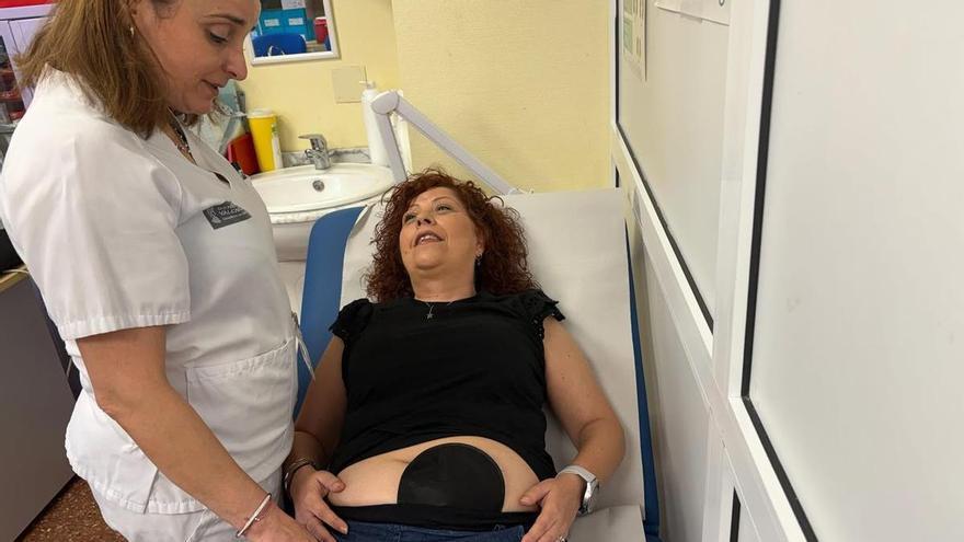 El Hospital Vega Baja rompe el tabú de cómo es vivir con una bolsa en el abdomen