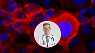 Síntomas para descubrir a tiempo la enfermedad más mortífera y difícil de diagnosticar