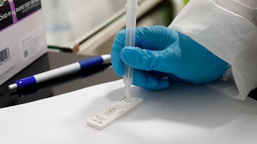 Aragón notifica 123 nuevos contagios de coronavirus y ningún fallecido