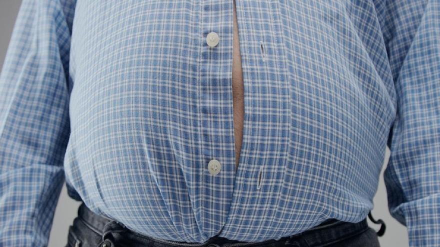 Una biopsia de la grasa corporal podría ayudar en el tratamiento de la obesidad