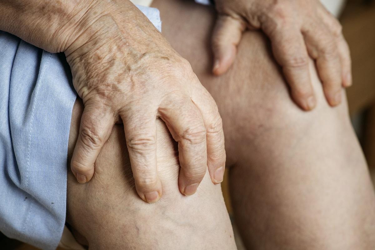 ¿Qué es la artrosis y por qué no se debe confundir con la artritis?