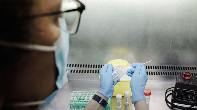 Una enfermera sostiene una prueba de análisis para la viruela del mono.