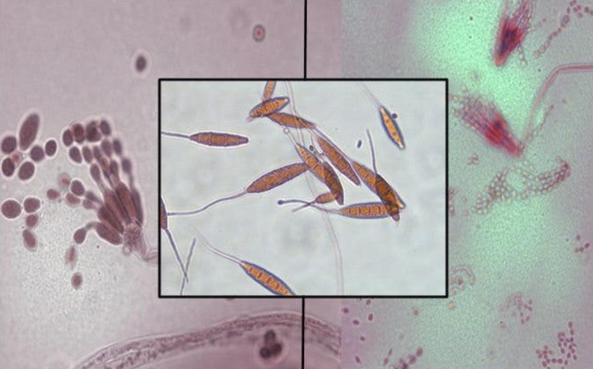 Hongo aspergillus (izquierda), microsporum (centro) y penicillium (derecha).